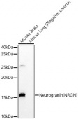 Neurogranin (NRGN) Rabbit mAb (A22700)