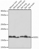 SOD1 Rabbit mAb (A12537)