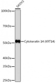 Cytokeratin 14 (KRT14) Rabbit mAb (A19039)