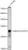 Galectin 3/LGALS3 Rabbit mAb (A22442)