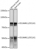 DCAMKL1/DCLK1 Rabbit mAb (A4372)