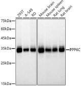 PPP6C Rabbit mAb (A9336)