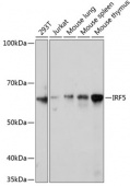 IRF5 Rabbit mAb (A11106)