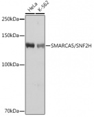 SMARCA5/SNF2H Rabbit mAb (A3539)