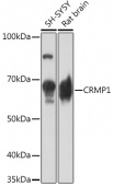 CRMP1 Rabbit mAb (A2390)