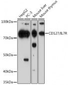 CD127/IL7R Rabbit mAb (A11678)