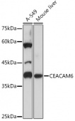CEACAM6 Rabbit mAb (A5971)