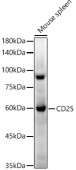 CD25 Rabbit mAb (A22479)