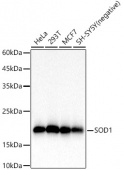 SOD1 Rabbit mAb (A22594)