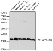 NME2/NM23B Rabbit mAb (A5621)