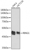 RING1A Rabbit mAb (A19750)