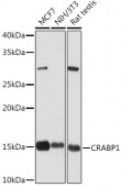 CRABP1 Rabbit mAb (A5434)