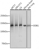 DDB1 Rabbit mAb (A5022)