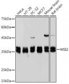 Musashi-2 (MSI2) Rabbit mAb (A19814)