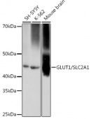 GLUT1/SLC2A1 Rabbit mAb (A11727)