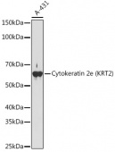 Cytokeratin 2e (KRT2) Rabbit mAb (A2615)