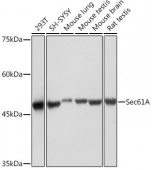 Sec61A Rabbit mAb (A19795)