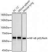 NF-kB p65/RelA Rabbit mAb (A19653)