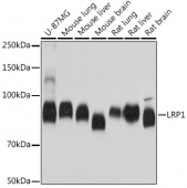 LRP1 Rabbit mAb (A0633)