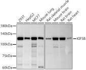 KIF5B Rabbit mAb (A20928)