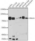 Menin Rabbit mAb (A3395)