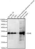 SDHB Rabbit mAb (A23832)