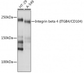 Integrin beta 4 (ITGB4/CD104) Rabbit mAb (A4596)