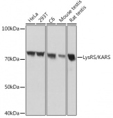 LysRS/KARS Rabbit mAb (A8648)