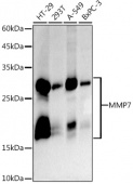 MMP7 Rabbit mAb (A20701)