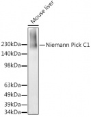 Niemann Pick C1 Rabbit mAb (A4795)