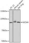 MCM4 Rabbit mAb (A9251)