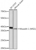 Musashi-1 (MSI1) Rabbit mAb (A9122)