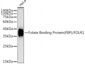 Folate Binding Protein(FBP) / FOLR1 Rabbit mAb (A20726)