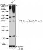 K48-linkage Specific Ubiquitin Rabbit mAb (A3606)