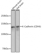 K-Cadherin (CDH6) Rabbit mAb (A4689)
