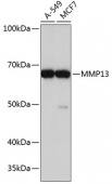 MMP13 Rabbit mAb (A11148)