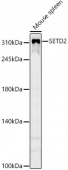 SETD2 Rabbit mAb (A23237)