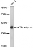 NCF4/p40-phox Rabbit mAb (A0935)