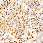 MDM2 Rabbit mAb (A23387)
