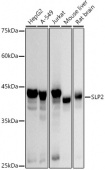 SLP2 Rabbit mAb (A20883)
