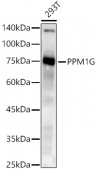 PPM1G Rabbit mAb (A20959)