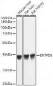 ENTPD5 Rabbit mAb (A19642)