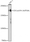 CD11a/LFA-1A/ITGAL Rabbit mAb (A19009)