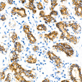 E-Cadherin mouse mAb (A3149)