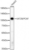 KAT2B/PCAF Rabbit mAb (A22719)