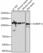 hnRNP U Rabbit mAb (A4257)