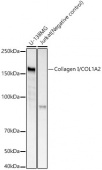 Collagen I/COL1A2 Rabbit mAb (A22349)