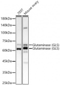 Glutaminase (GLS) Rabbit mAb (A23189)