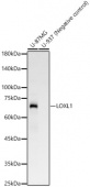 LOXL1 Rabbit mAb (A23079)