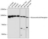 Glucocorticoid Receptor Rabbit mAb (A19583)